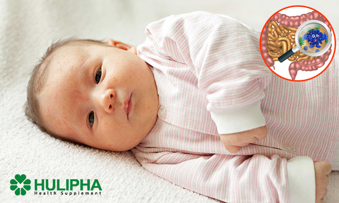 Vi Khuẩn Trong Ruột Của Trẻ Sơ Sinh Không Xuất Hiện Trước Khi Sinh